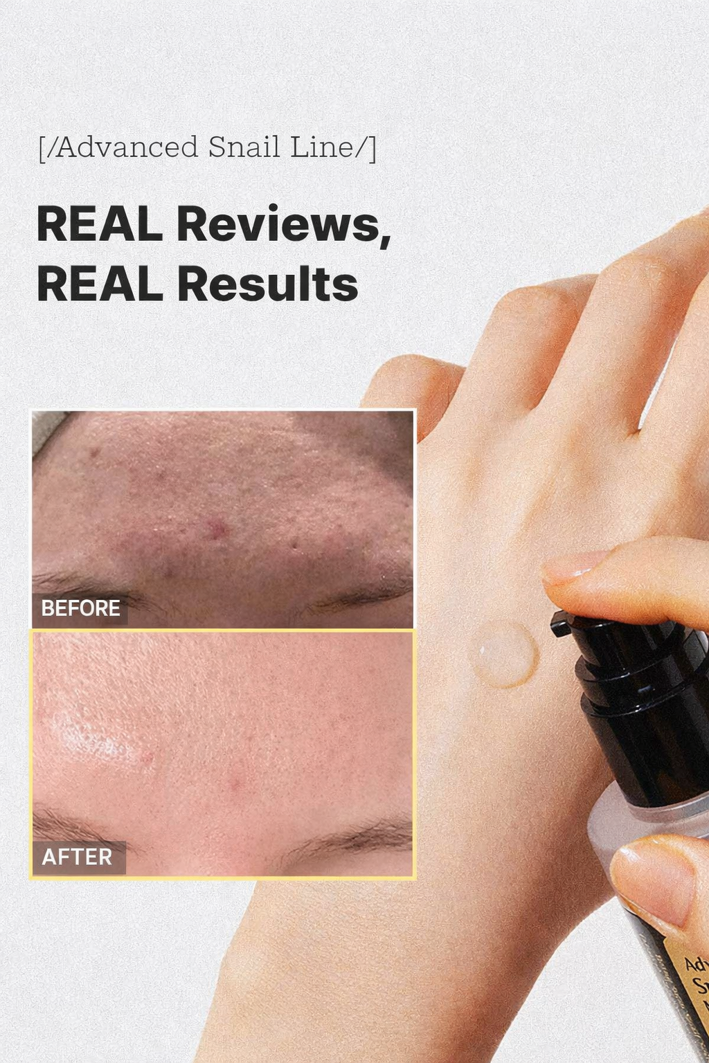 Lumelle™ Snail 96 Snail Mucin
