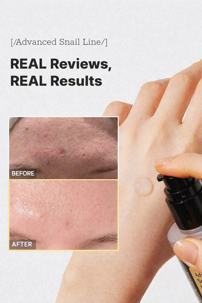 Lumelle™ Snail 96 Snail Mucin